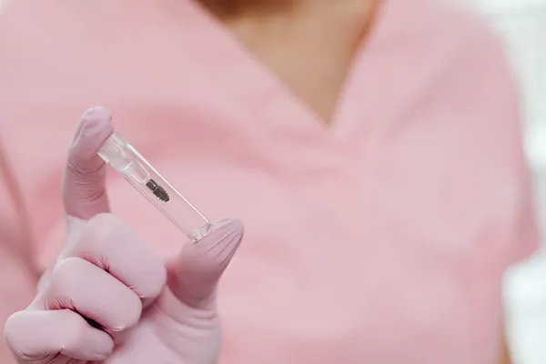 Titanium dental implant post — the biocompatible component placed into jawbone during dental implant surgery at safe, accredited clinics in Turkey