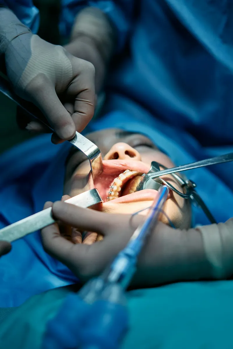 Dental surgical team performing an implant procedure — qualified oral surgeons and surgical nurses working in a sterile environment at a safe, accredited dental clinic
