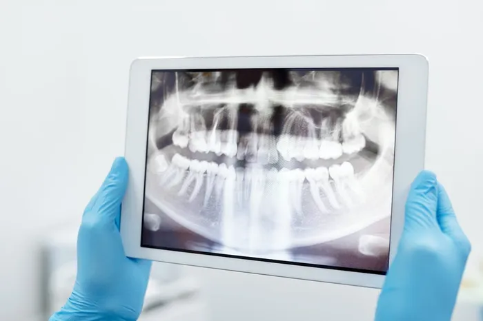 Dentist reviewing a dental X-ray on a tablet — advanced digital diagnostics at accredited clinics reduce the risk of misdiagnosis and enable precise treatment planning for overseas patients
